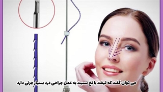 آیا لیفت بینی با نخ درد دارد؟