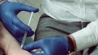 تزریق بوتاکس زیر بغل (بوتاکس تعریق)