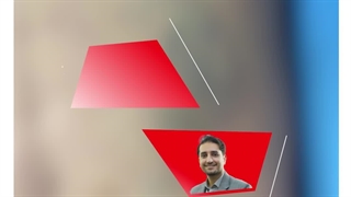 درمان واریس از طریق اسکلروتراپی 2-