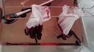 روش تغذیه زالوها با دستکش استریل |صنعت زالو ایران