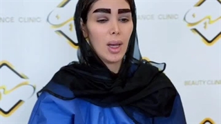 کاشت ابرو بدون جراحی به روش sut